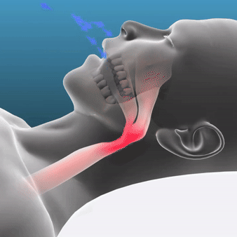 Trainovaa™ - Sleep Apnea & Anti-Snoring Guard